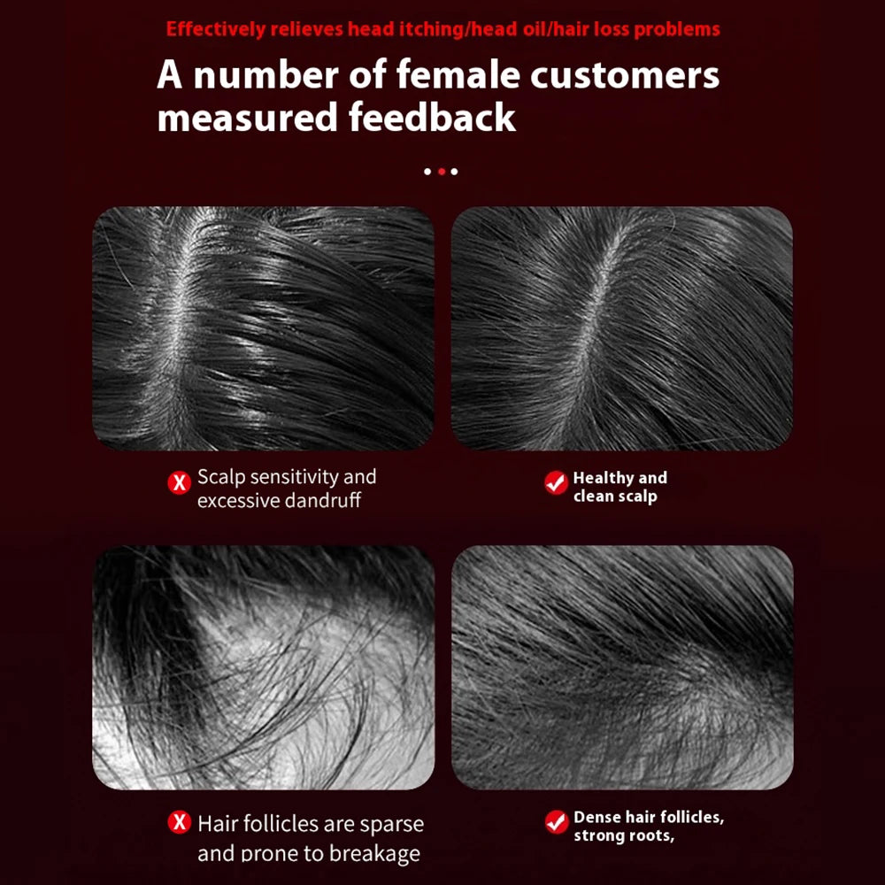 Electric Hair Regrowth Brush with Infrared Light Acupoint Scalp Massage