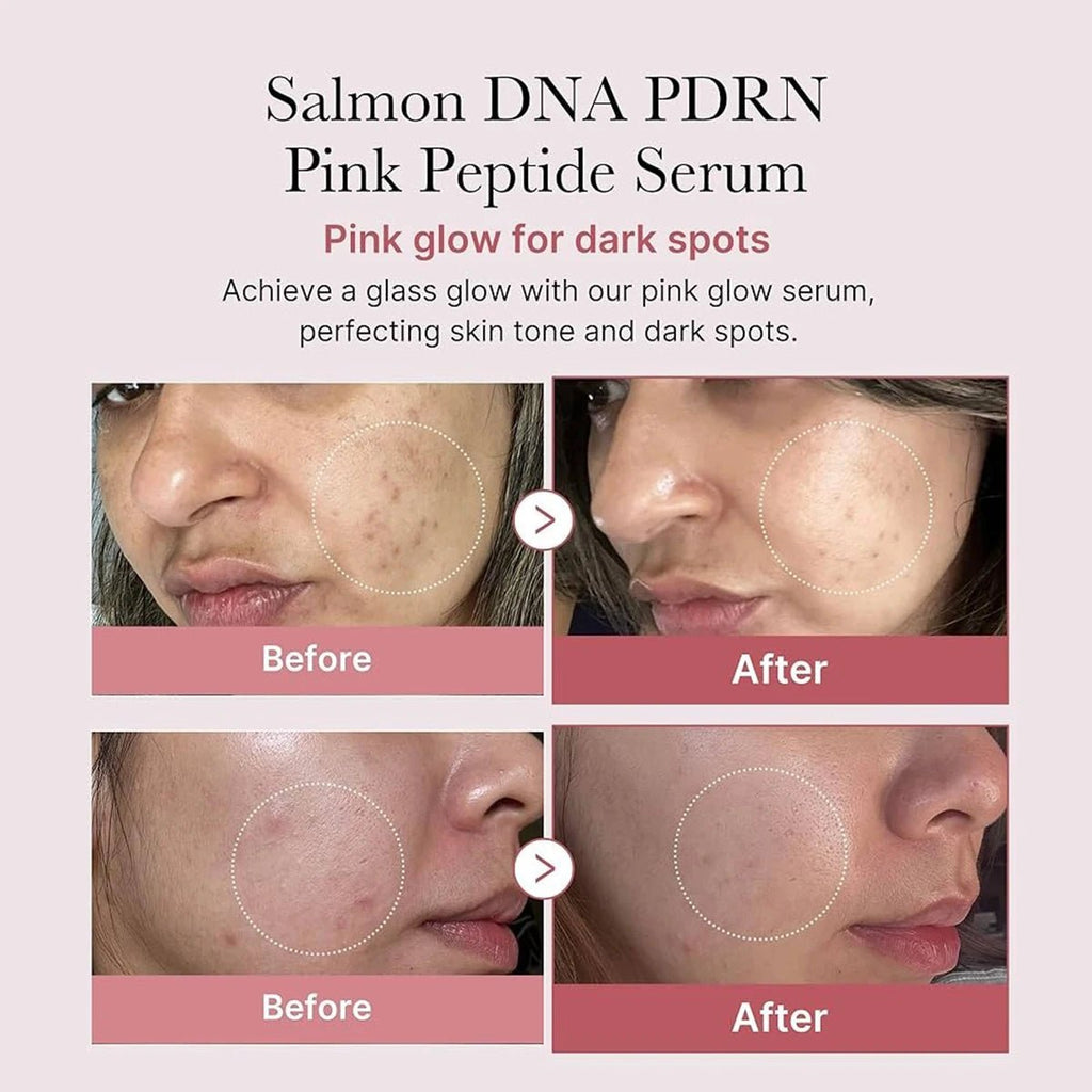 Medicube Salmon DNA PDRN Pink Peptide Serum - ItemDrop