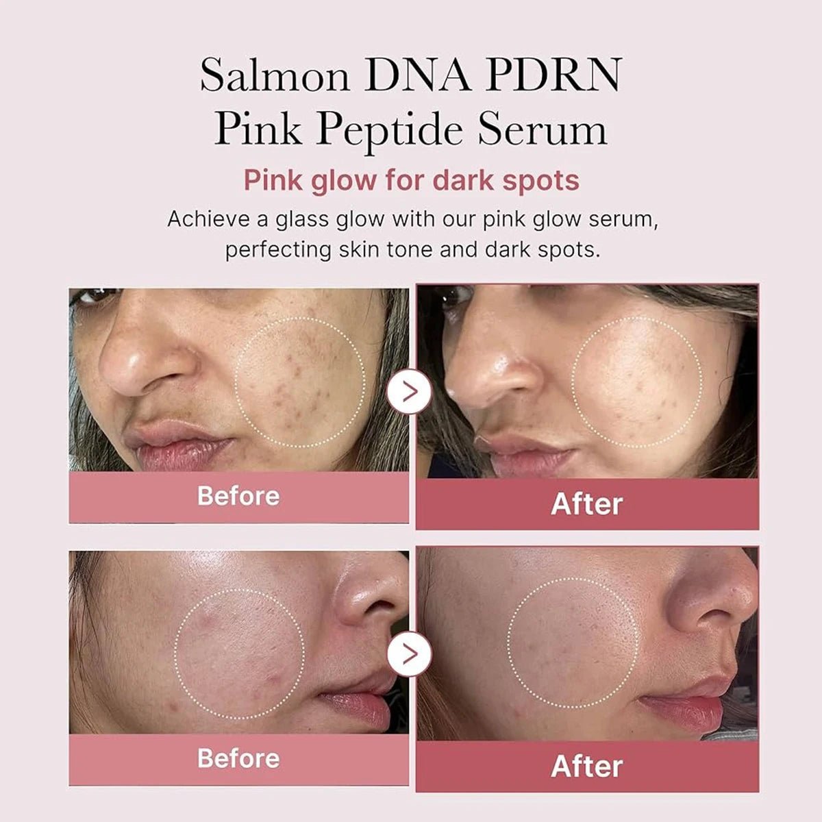 Medicube Salmon DNA PDRN Pink Peptide Serum - ItemDrop